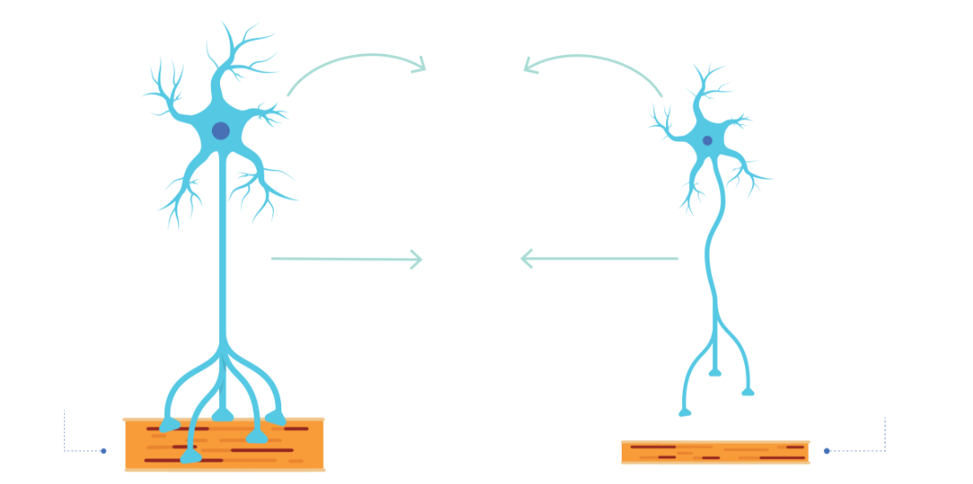 Zwyrodnienie neuronów ruchowych prowadzi do postępującego zmniejszenia masy i siły mięśni (zanik). 
